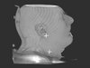 Cancer-Care-Institute-Cone-Beam-CT-Head-And-Neck